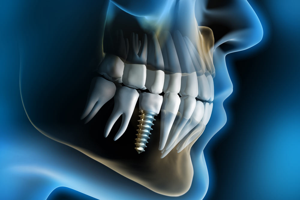 Implantology 2